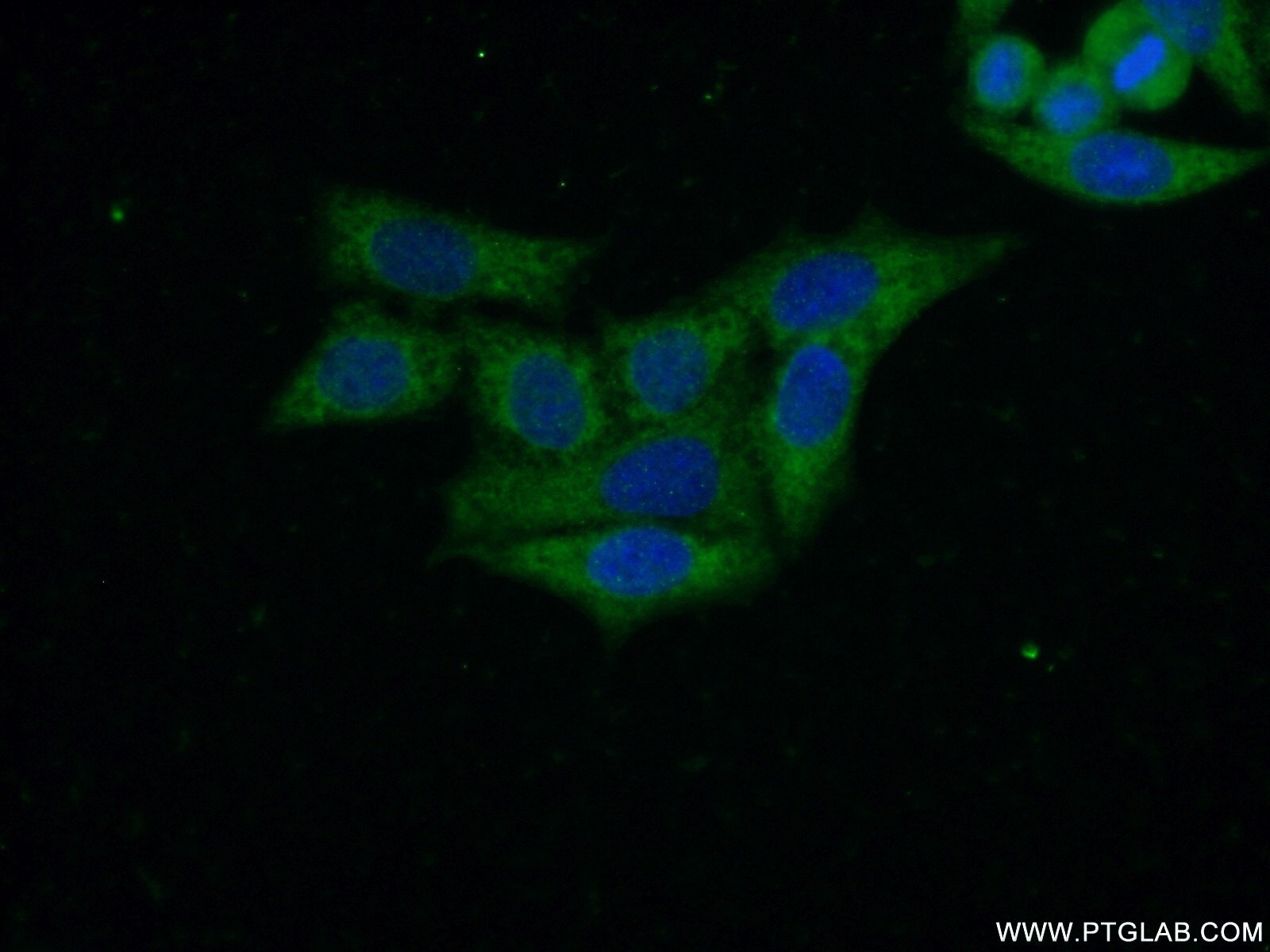 Immunofluorescence (IF) / fluorescent staining of HeLa cells using C14orf28 Polyclonal antibody (26130-1-AP)