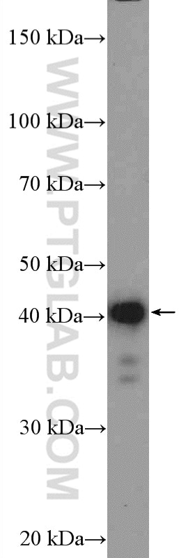 Western Blot (WB) analysis of HeLa cells using C14orf28 Polyclonal antibody (26130-1-AP)