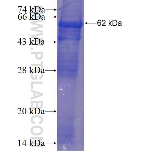 C14orf28 fusion protein Ag23441 SDS-PAGE