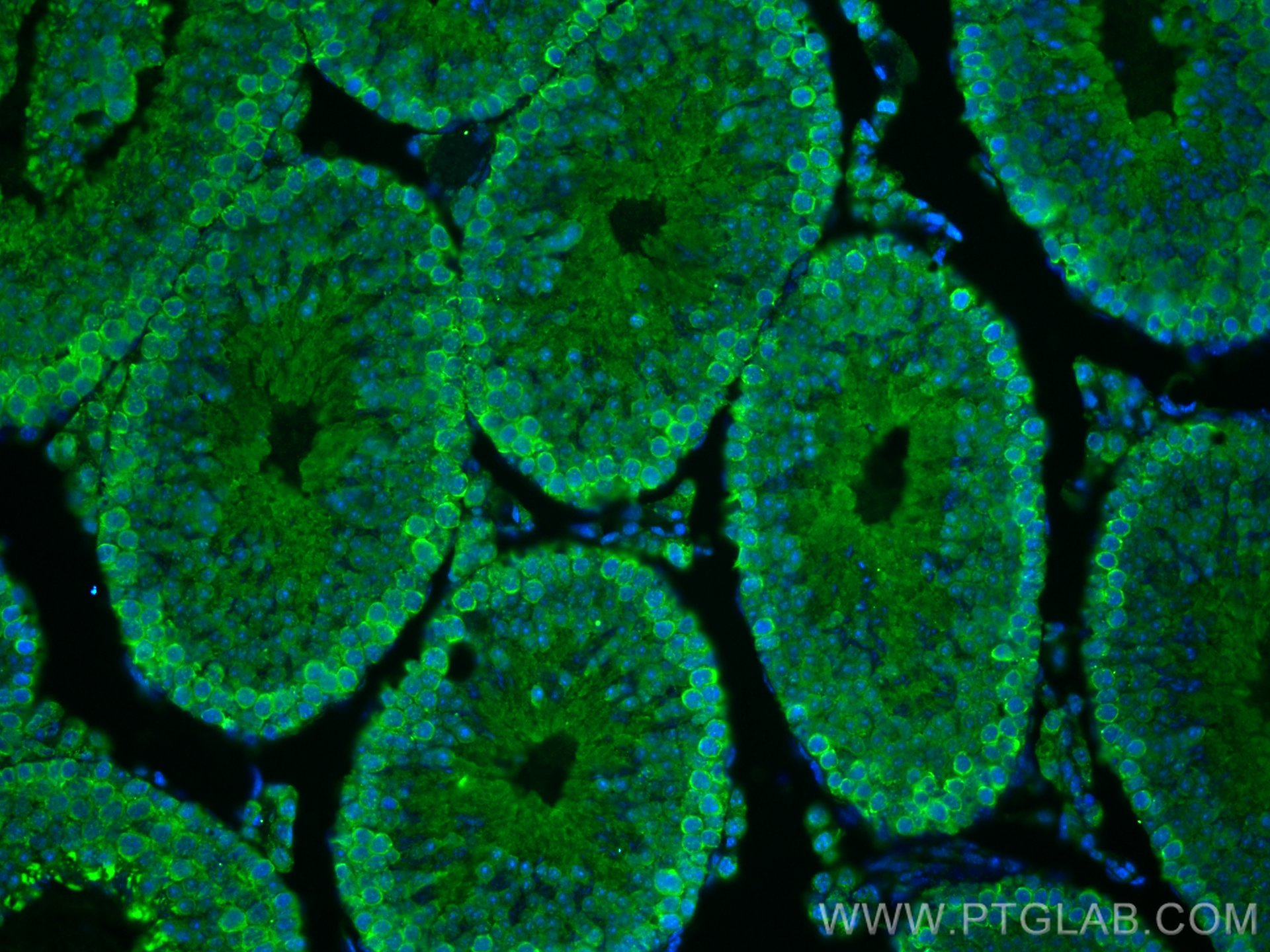 Immunofluorescence (IF) / fluorescent staining of mouse testis tissue using C14orf39 Polyclonal antibody (22664-1-AP)