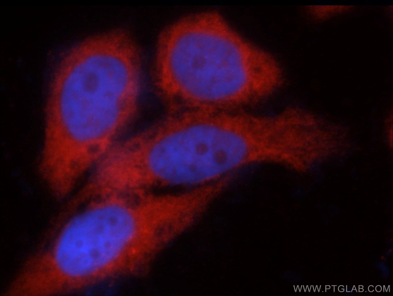 IF Staining of MCF-7 using 22664-1-AP