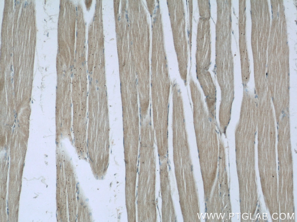 Immunohistochemistry (IHC) staining of human skeletal muscle tissue using C14orf39 Polyclonal antibody (22664-1-AP)