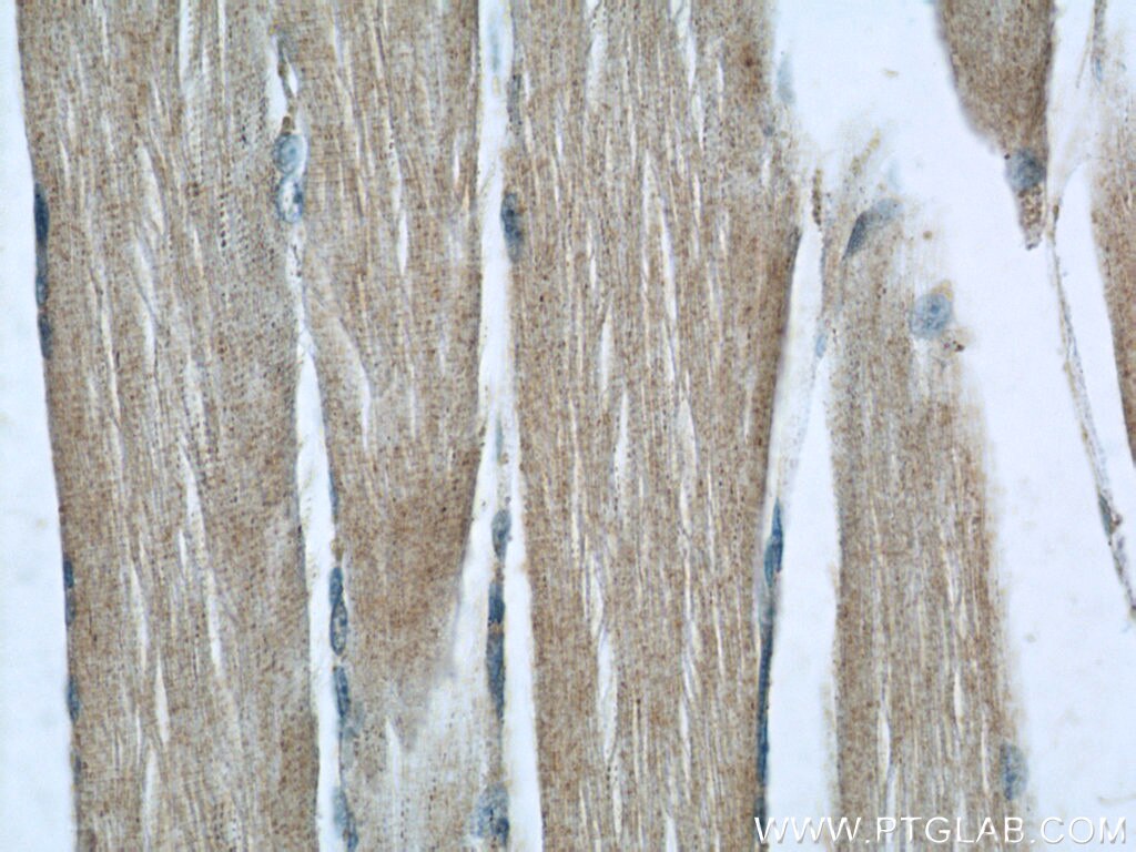 Immunohistochemistry (IHC) staining of human skeletal muscle tissue using C14orf39 Polyclonal antibody (22664-1-AP)