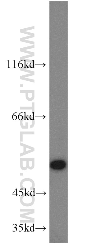 Western Blot (WB) analysis of SKOV-3 cells using C14orf39 Polyclonal antibody (22664-1-AP)