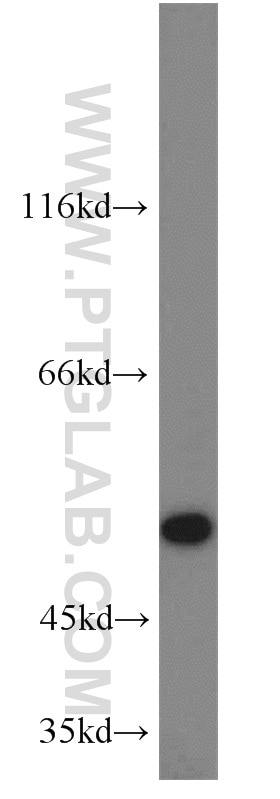 WB analysis of SKOV-3 using 22664-1-AP