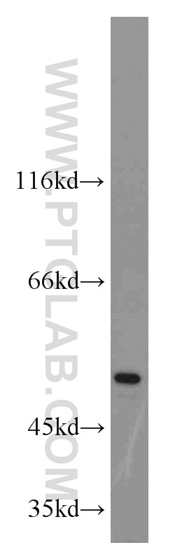 Western Blot (WB) analysis of HeLa cells using C14orf39 Polyclonal antibody (22664-1-AP)