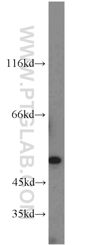 Western Blot (WB) analysis of Jurkat cells using C14orf39 Polyclonal antibody (22664-1-AP)