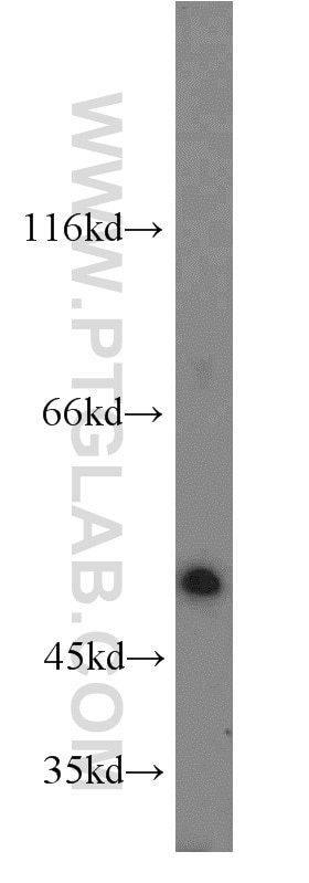 Western Blot (WB) analysis of mouse colon tissue using C14orf39 Polyclonal antibody (22664-1-AP)