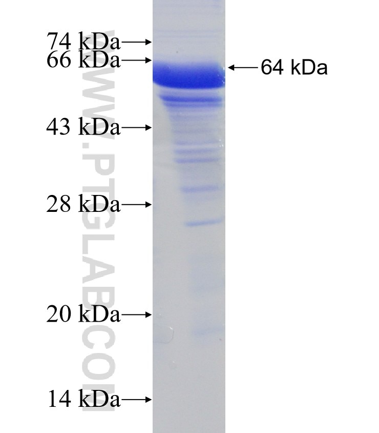 C14orf39 fusion protein Ag18589 SDS-PAGE
