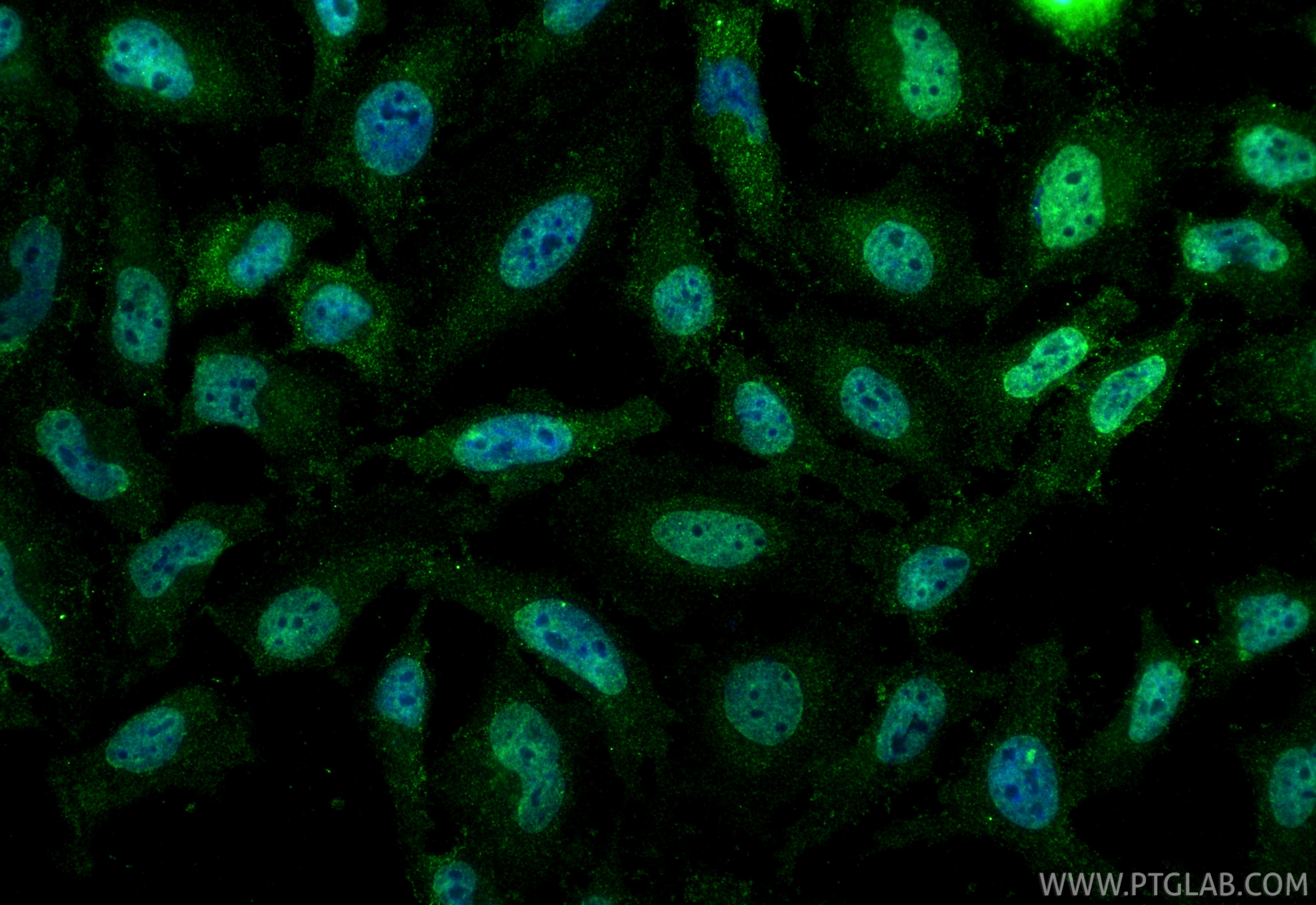 Immunofluorescence (IF) / fluorescent staining of HeLa cells using Nesprin 3 Monoclonal antibody (68420-1-Ig)