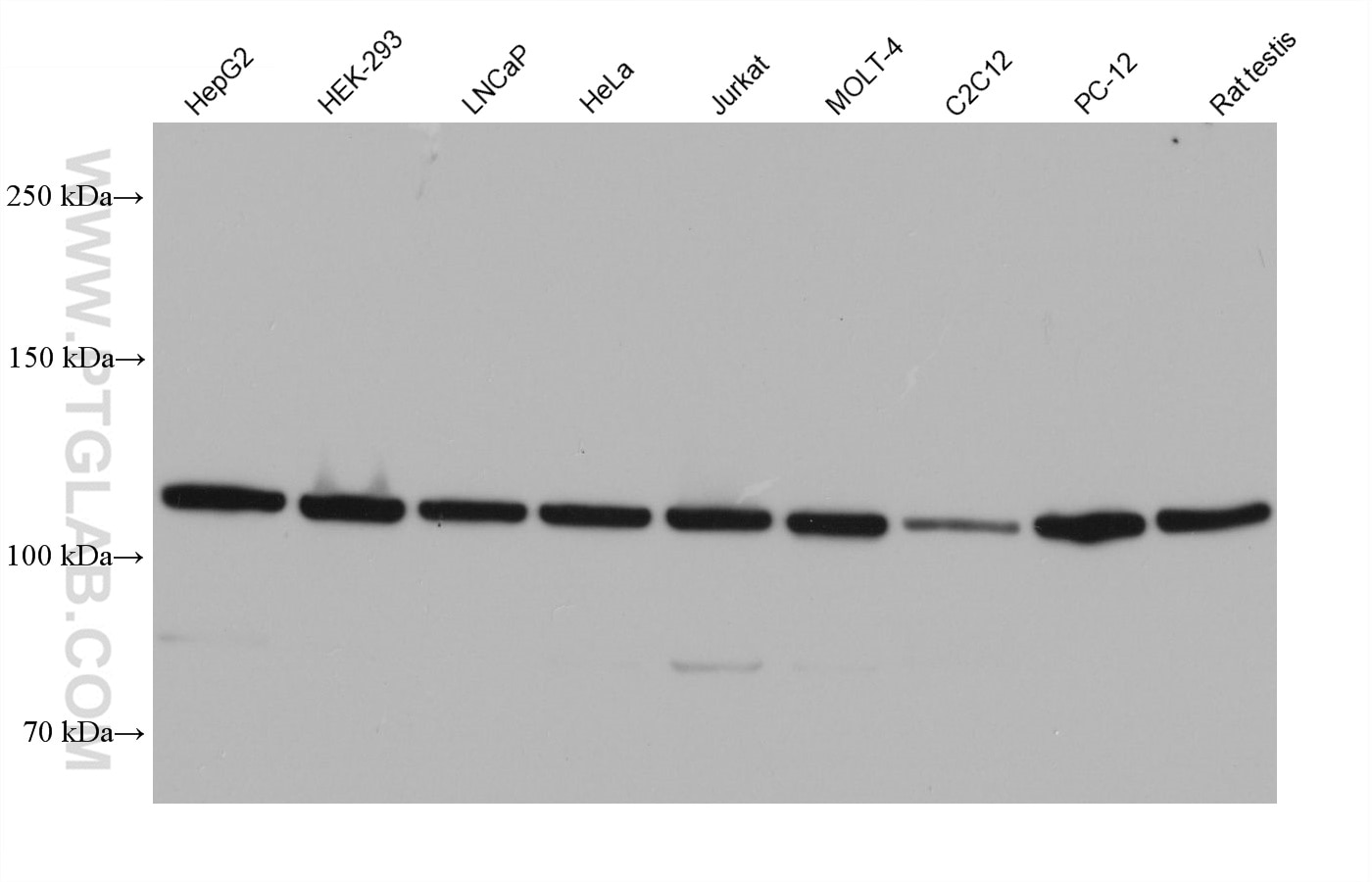 Western Blot (WB) analysis of various lysates using Nesprin 3 Monoclonal antibody (68420-1-Ig)