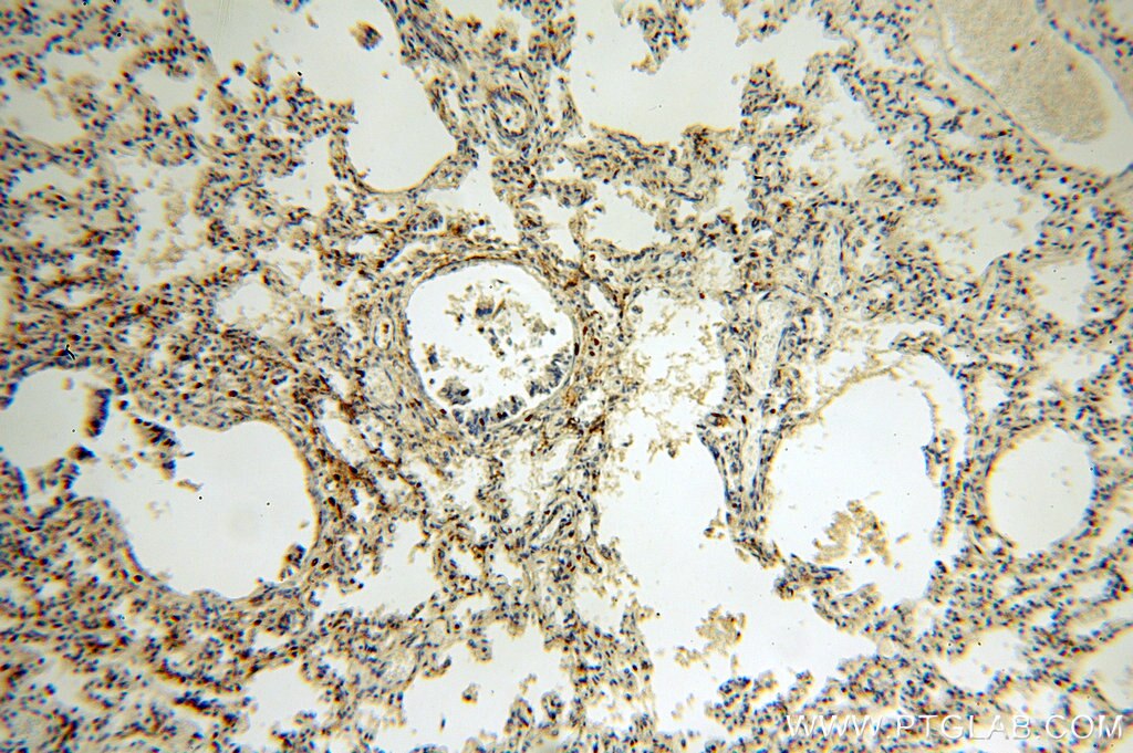 Immunohistochemistry (IHC) staining of human lung tissue using C14orf94 Polyclonal antibody (20115-1-AP)