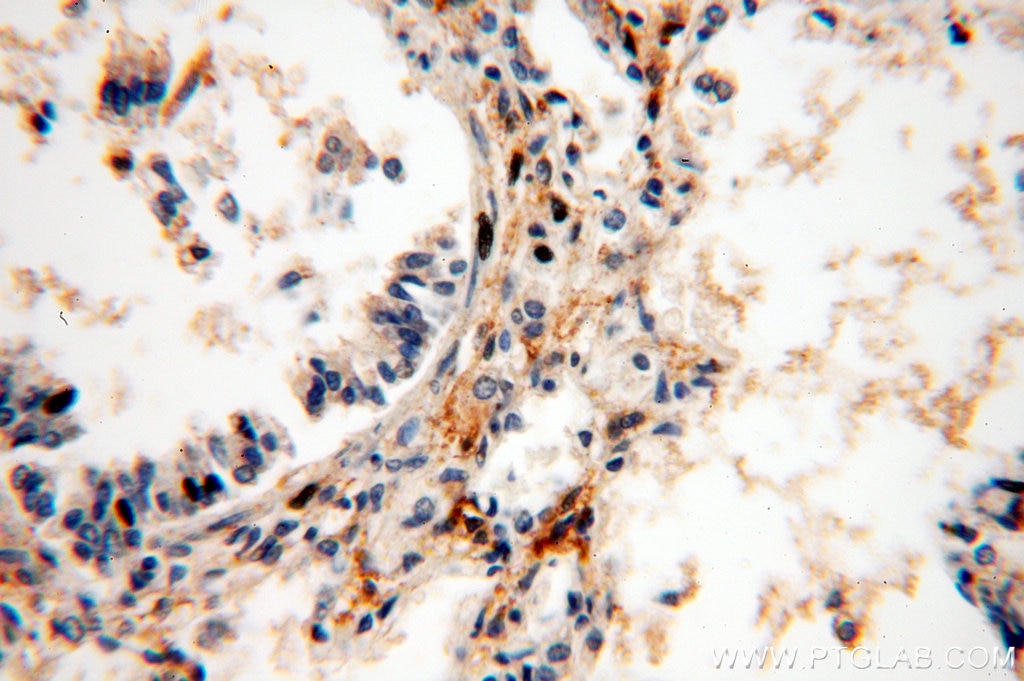 IHC staining of human lung using 20115-1-AP
