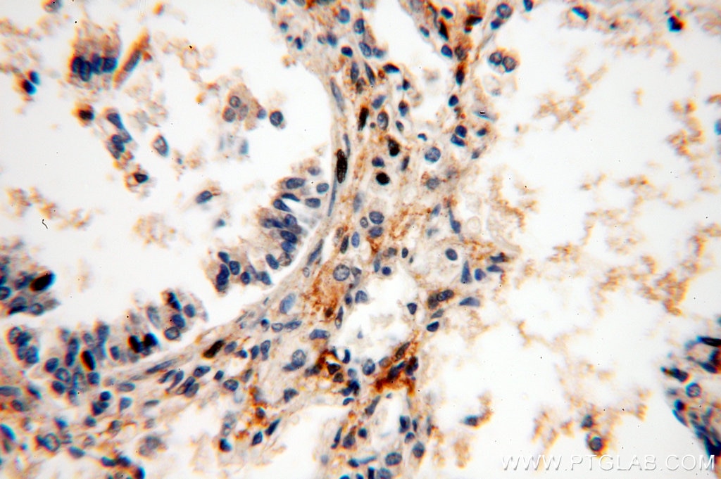 Immunohistochemistry (IHC) staining of human lung tissue using C14orf94 Polyclonal antibody (20115-1-AP)