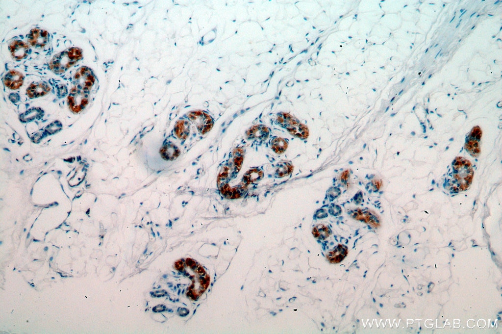 Immunohistochemistry (IHC) staining of human skin tissue using C14orf94 Polyclonal antibody (20115-1-AP)
