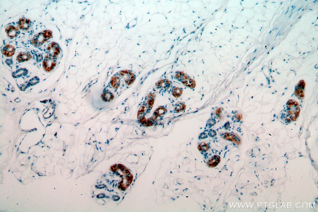 IHC staining of human skin using 20115-1-AP