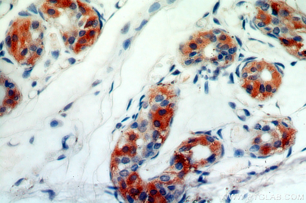 Immunohistochemistry (IHC) staining of human skin tissue using C14orf94 Polyclonal antibody (20115-1-AP)
