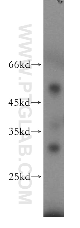 Western Blot (WB) analysis of mouse skin tissue using C14orf94 Polyclonal antibody (20115-1-AP)