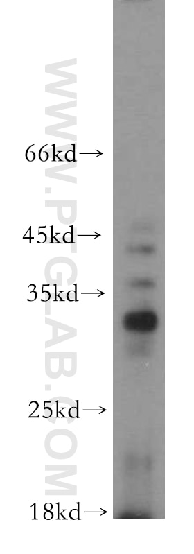 Western Blot (WB) analysis of PC-3 cells using C14orf94 Polyclonal antibody (20115-1-AP)