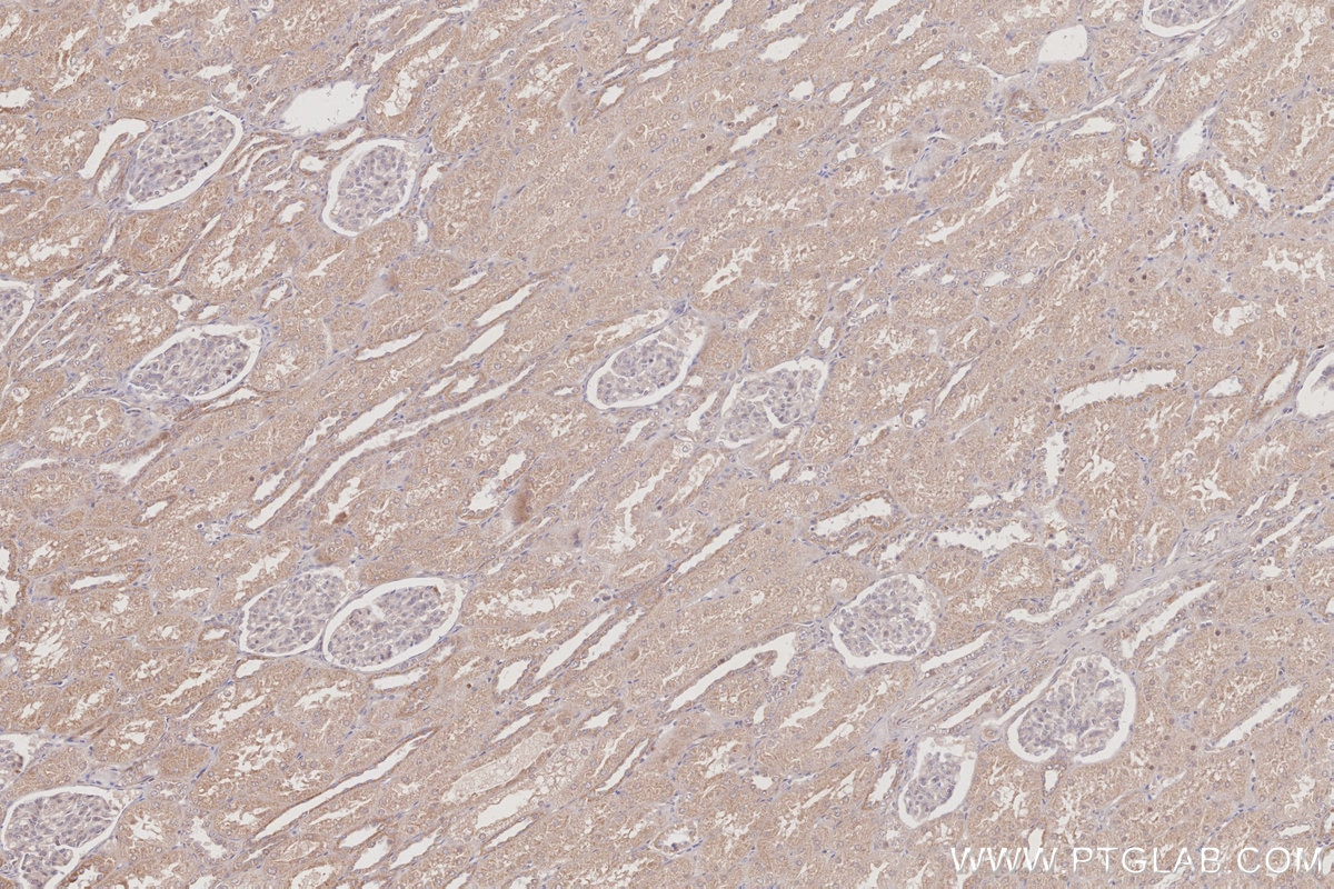 IHC staining of human kidney using 26189-1-AP Immunohistochemistry (IHC) staining of human kidney tissue using C15orf23 Polyclonal antibody (26189-1-AP)