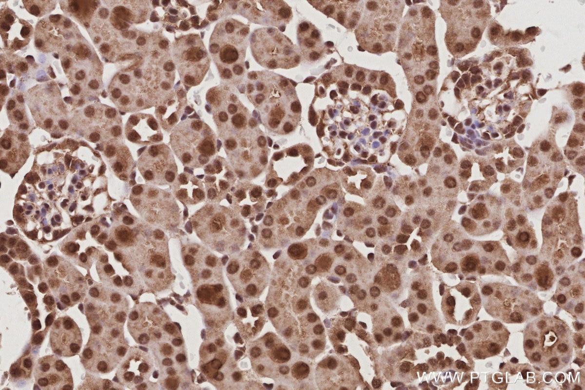 IHC staining of mouse kidney using 26189-1-AP Immunohistochemistry (IHC) staining of mouse kidney tissue using C15orf23 Polyclonal antibody (26189-1-AP)