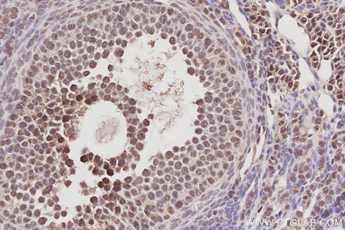 IHC staining of mouse ovary using 26189-1-AP Immunohistochemistry (IHC) staining of mouse ovary tissue using C15orf23 Polyclonal antibody (26189-1-AP)
