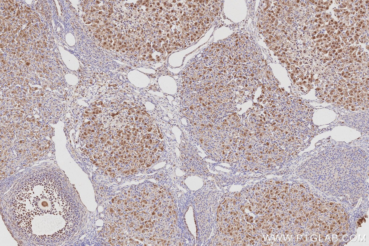 IHC staining of rat ovary using 26189-1-AP Immunohistochemistry (IHC) staining of rat ovary tissue using C15orf23 Polyclonal antibody (26189-1-AP)
