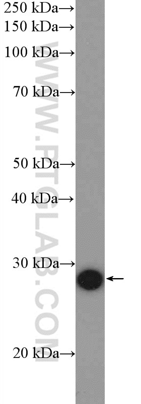 Western Blot (WB) analysis of HL-60 cells using C15orf23 Polyclonal antibody (26189-1-AP)