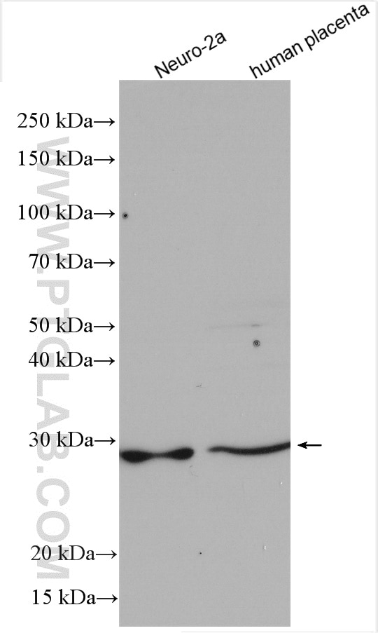Western Blot (WB) analysis of various lysates using C15orf29 Polyclonal antibody (24795-1-AP)