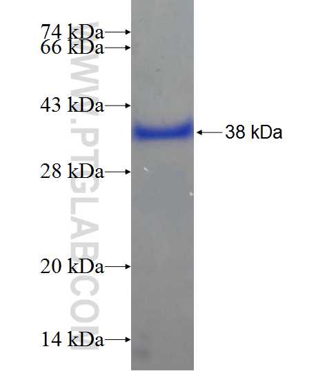 C15orf29 fusion protein Ag20700 SDS-PAGE