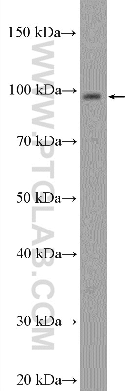 Western Blot (WB) analysis of A549 cells using C15orf39 Polyclonal antibody (20126-1-AP)