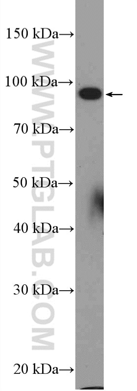 Western Blot (WB) analysis of HeLa cells using C15orf39 Polyclonal antibody (20126-1-AP)