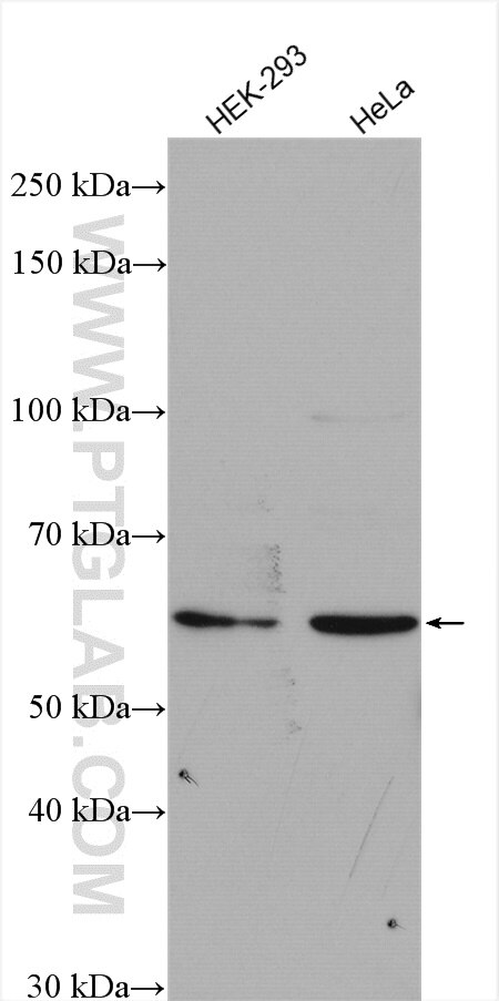 Western Blot (WB) analysis of various lysates using C15orf44 Polyclonal antibody (25227-1-AP)