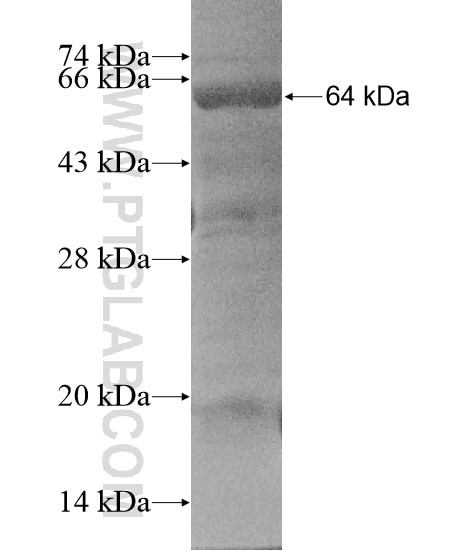 C15orf44 fusion protein Ag19785 SDS-PAGE