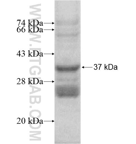 C15orf5 fusion protein Ag16015 SDS-PAGE