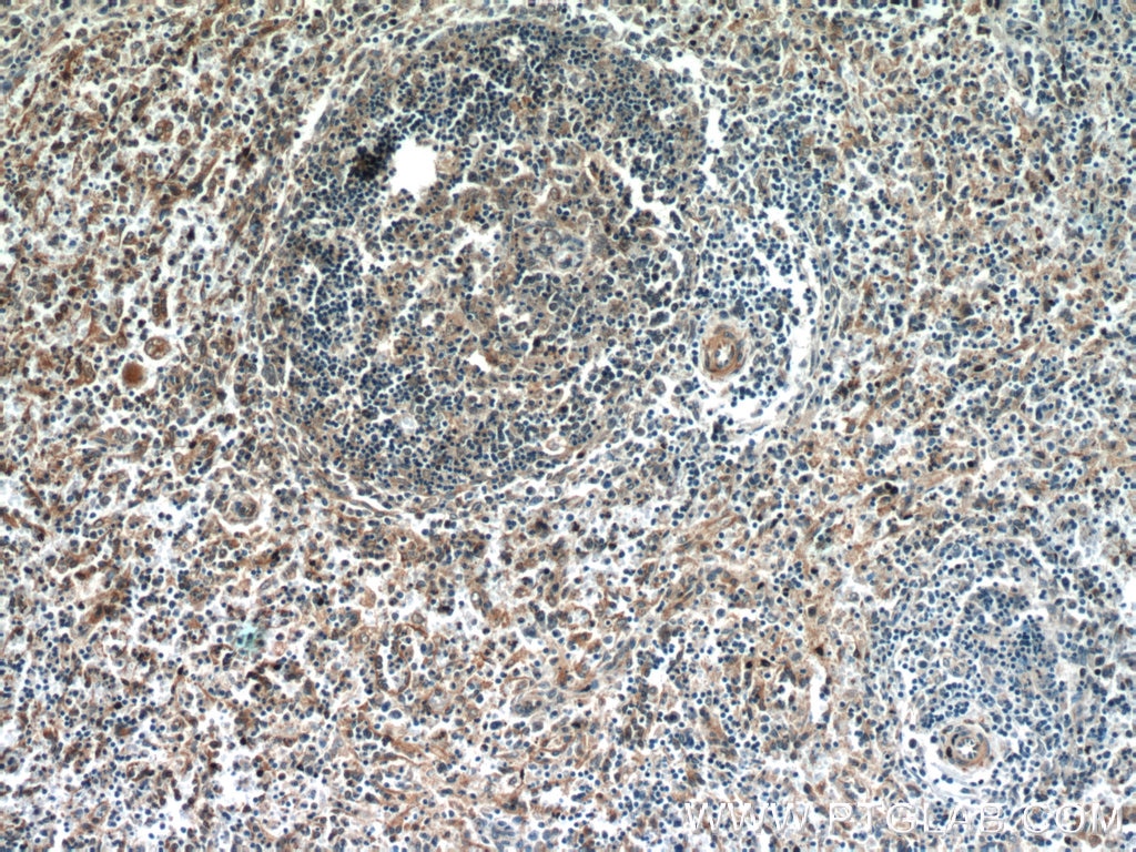 Immunohistochemistry (IHC) staining of human spleen tissue using C15orf53 Polyclonal antibody (24553-1-AP)