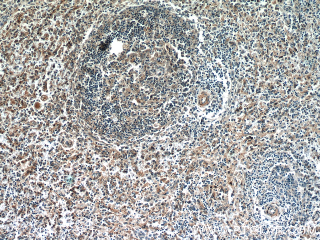 IHC staining of human spleen using 24553-1-AP