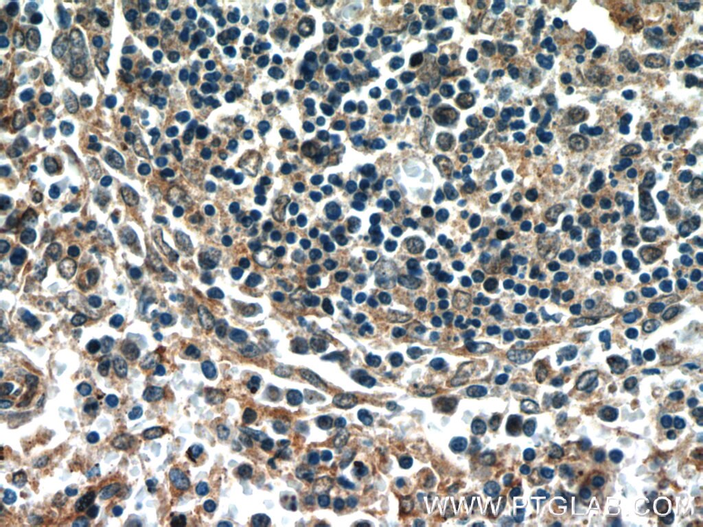 IHC staining of human spleen using 24553-1-AP