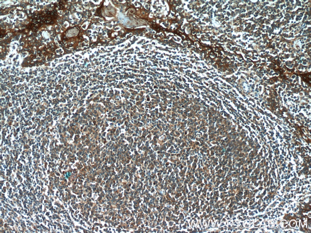 Immunohistochemistry (IHC) staining of human tonsillitis tissue using C15orf53 Polyclonal antibody (24553-1-AP)