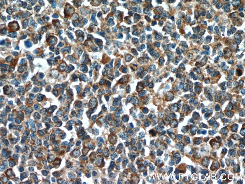 Immunohistochemistry (IHC) staining of human tonsillitis tissue using C15orf53 Polyclonal antibody (24553-1-AP)