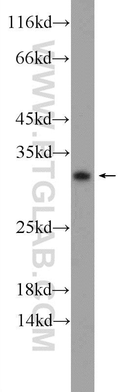 Western Blot (WB) analysis of A431 cells using C15orf53 Polyclonal antibody (24553-1-AP)