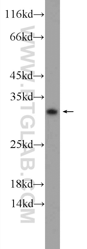 Western Blot (WB) analysis of A431 cells using C15orf53 Polyclonal antibody (24553-1-AP)