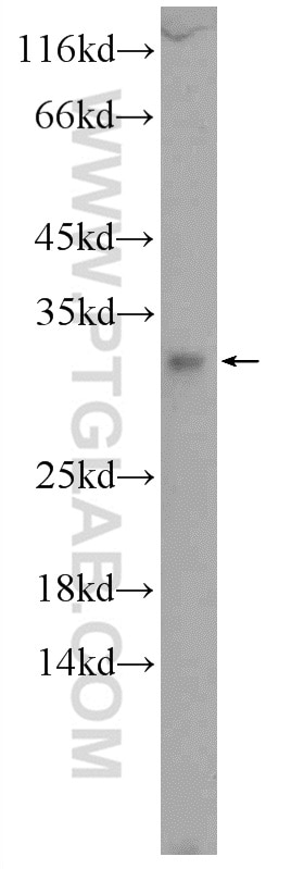 Western Blot (WB) analysis of COLO 320 cells using C15orf53 Polyclonal antibody (24553-1-AP)