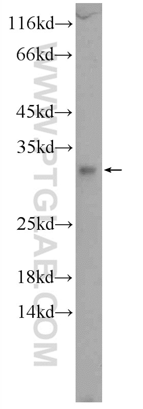 WB analysis of COLO 320 using 24553-1-AP