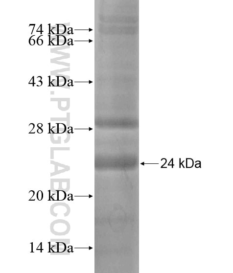 C15orf53 fusion protein Ag18630 SDS-PAGE