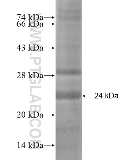 C15orf53 fusion protein Ag18630 SDS-PAGE