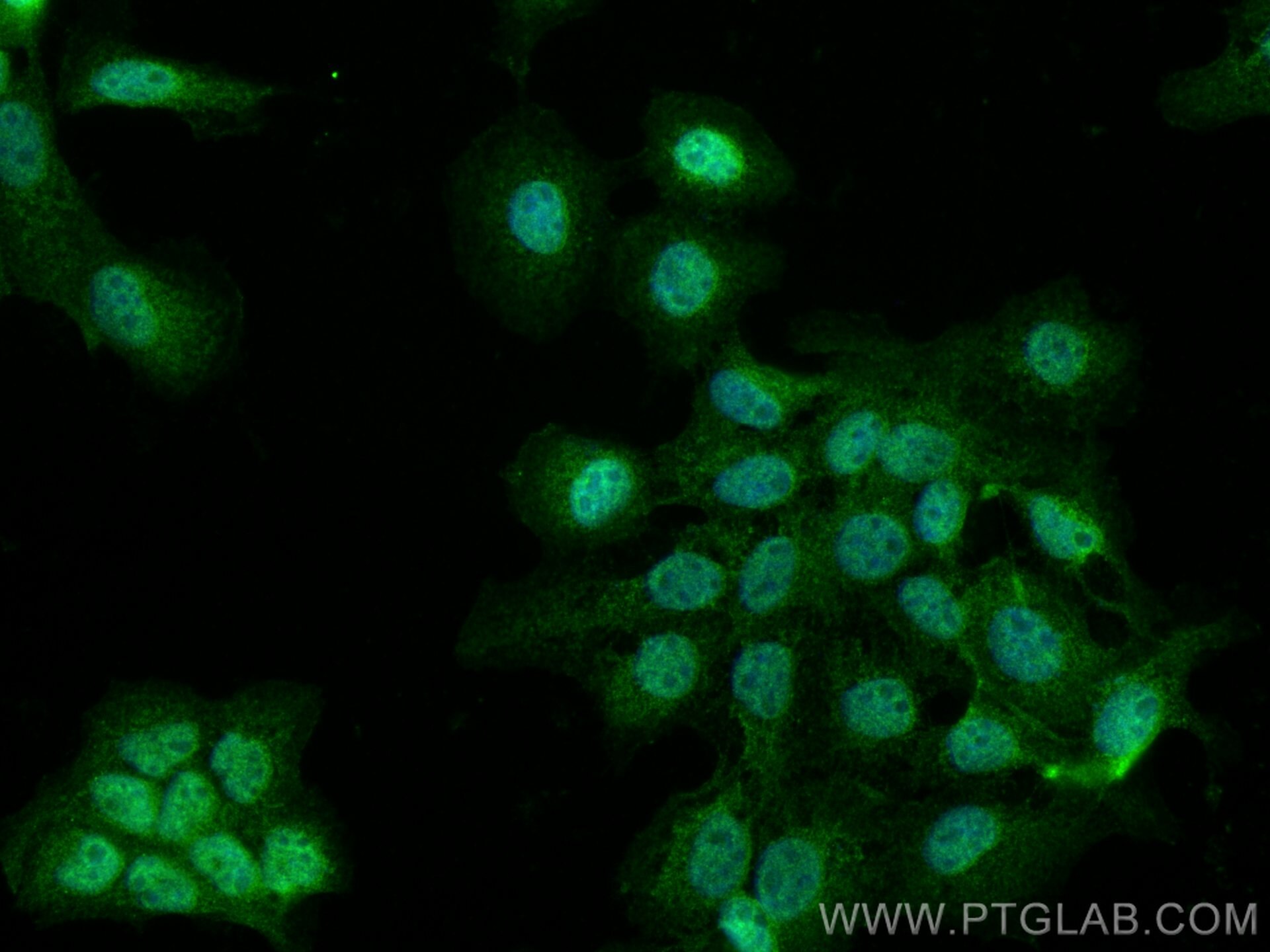 Immunofluorescence (IF) / fluorescent staining of A431 cells using C15orf55 Polyclonal antibody (28639-1-AP)
