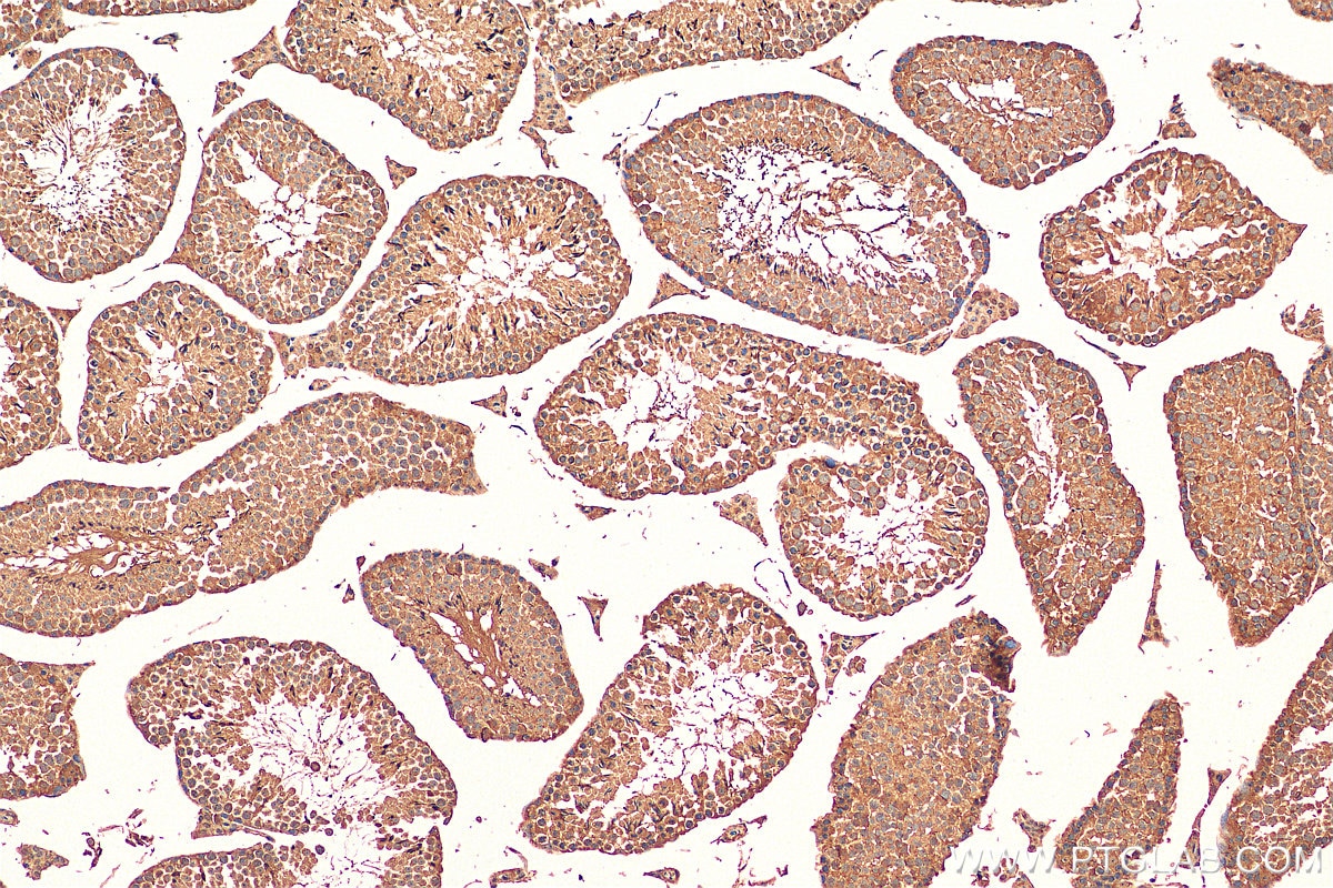Immunohistochemistry (IHC) staining of mouse testis tissue using C15orf55 Polyclonal antibody (28639-1-AP)
