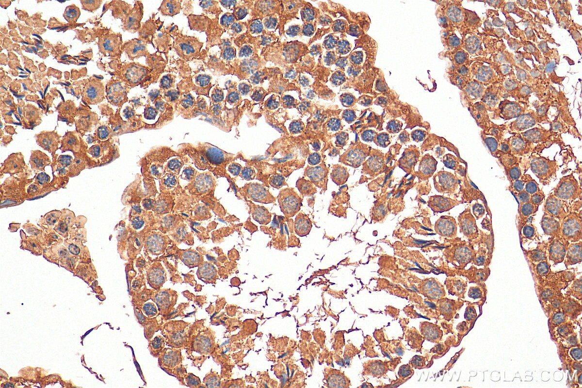 Immunohistochemistry (IHC) staining of mouse testis tissue using C15orf55 Polyclonal antibody (28639-1-AP)