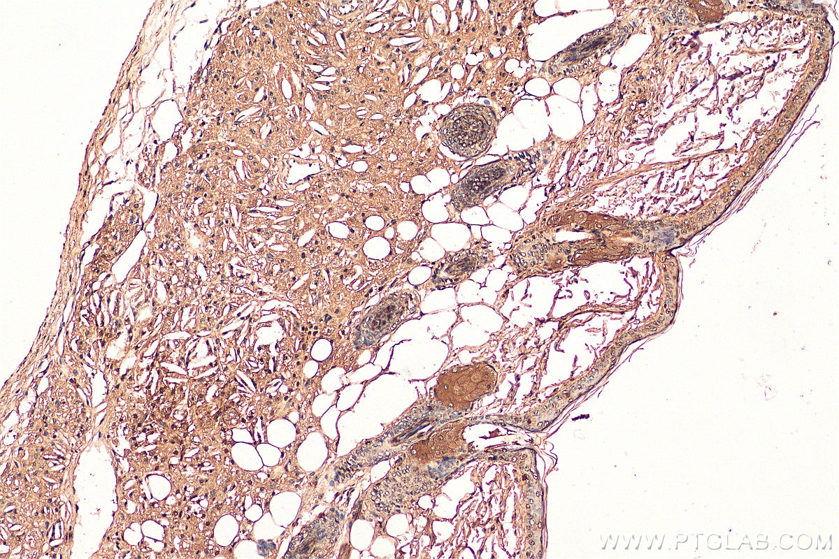 Immunohistochemistry (IHC) staining of mouse skin tissue using C15orf55 Polyclonal antibody (28639-1-AP)